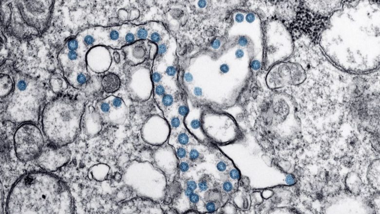 Shkencëtarët krijojnë antitrupa që mposhtin coronavirusin në laborator