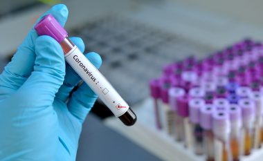 Qytetarët paguajnë deri në 120 euro për testin për coronavirus