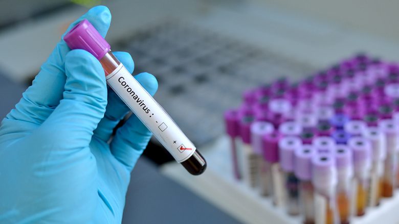 Qytetarët paguajnë deri në 120 euro për testin për coronavirus