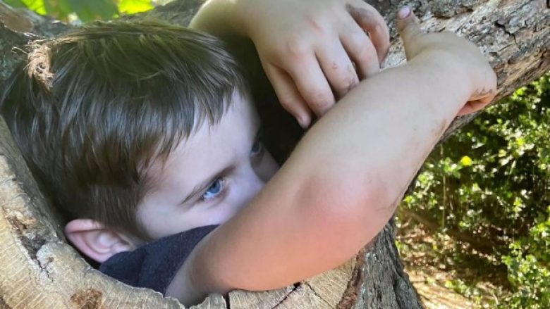 Katërvjeçari bllokohet brenda një peme në një park të Anglisë