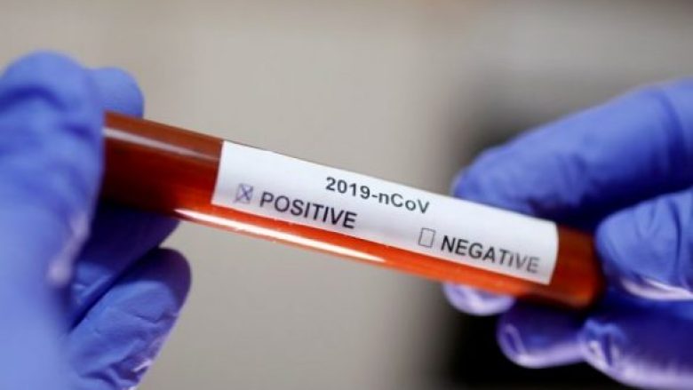 Regjistrohen 125 raste të reja me coronavirus në Maqedoni