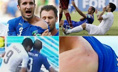 Chiellini thotë se e admiron Suarezin për kafshimin që i ia bëri në Kampionatin Botëror