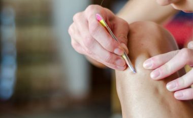 Dermatologët propozojnë tri mënyra të eliminimit të qimeve në shtëpi