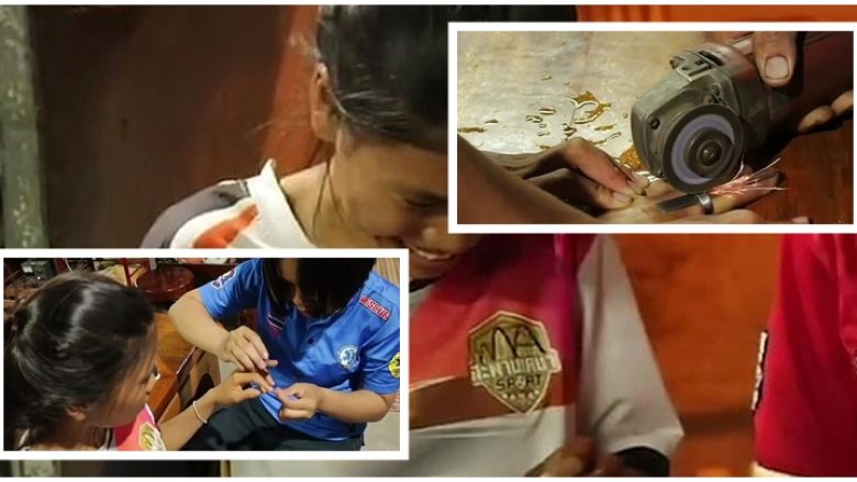 Nga darat e deri te sharra elektrike, mjekët përdorën të gjitha veglat e punës për t’ia hequr unazën që i kishte ngecur në gisht tajlandezes