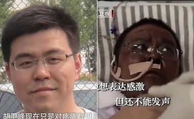 I ishte ndërruar ngjyra e lëkurës pasi ishte infektuar me coronavirus, ndërron jetë mjeku kinez që punoi në spitalin e Wuhanit