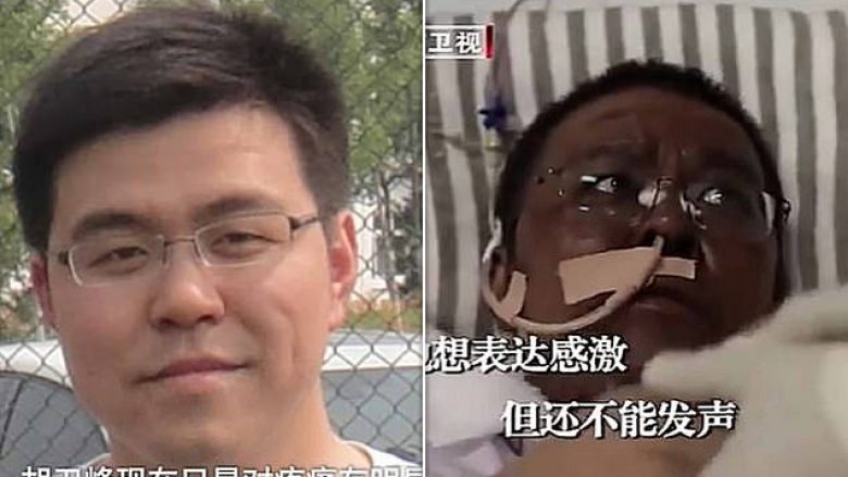 I ishte ndërruar ngjyra e lëkurës pasi ishte infektuar me coronavirus, ndërron jetë mjeku kinez që punoi në spitalin e Wuhanit