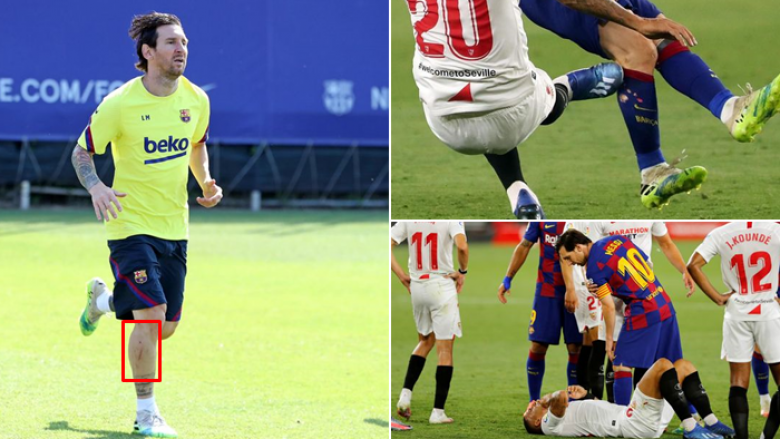 Lëndimi i Messit i pësuar në barazimin ndaj Sevillës shqetëson Barcelonën – ylli argjentinas shihet me një plagë serioze në këmbën e djathtë