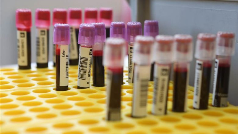 Testi i gjakut i cili mund të zbulojë pesë lloje të kancerit katër vite para shfaqjes së simptomave
