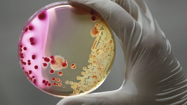 Për herë të parë: Zbulohen aksidentalisht bakteret që hanë metalin