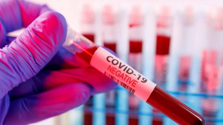 Shërohen nga coronavirusi 15 qytetarë në Deçan, mbesin aktive edhe 28 raste