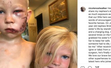 Gjashtëvjeçari shpëtoi motrën nga sulmi i një qeni dhe përfundoi me 90 qepje në fytyrën e tij