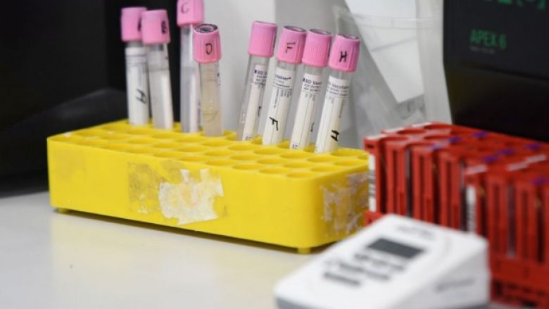 Një i vdekur dhe 71 raste të reja të infektuar me coronavirus në Kroaci