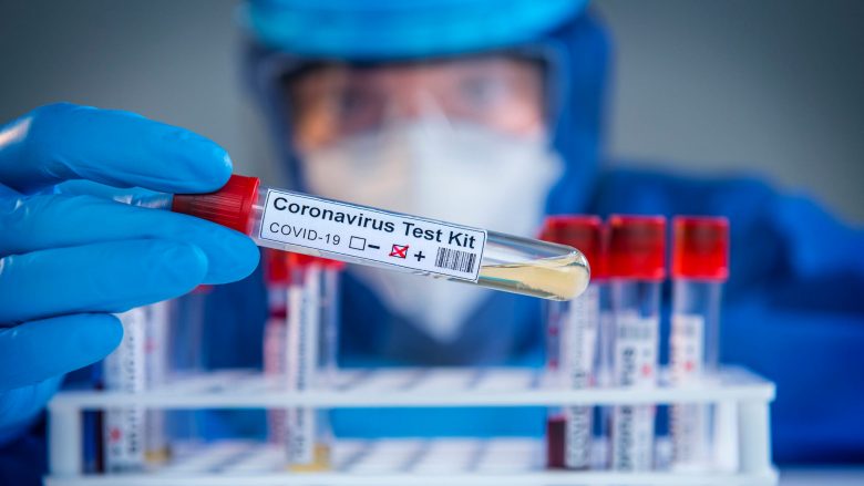 Nis shqyrtimi i aplikacioneve për licencimin e rreth 100 laboratorëve privatë për testimet e COVID-19