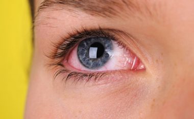 A mund të infektohemi me COVID-19 përmes syve?