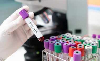 Testimi për COVID-19 edhe në laboratorët privatë