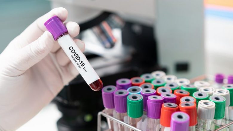 MSH vazhdon licencimin e laboratorëve privat për testime serologjike për COVID-19