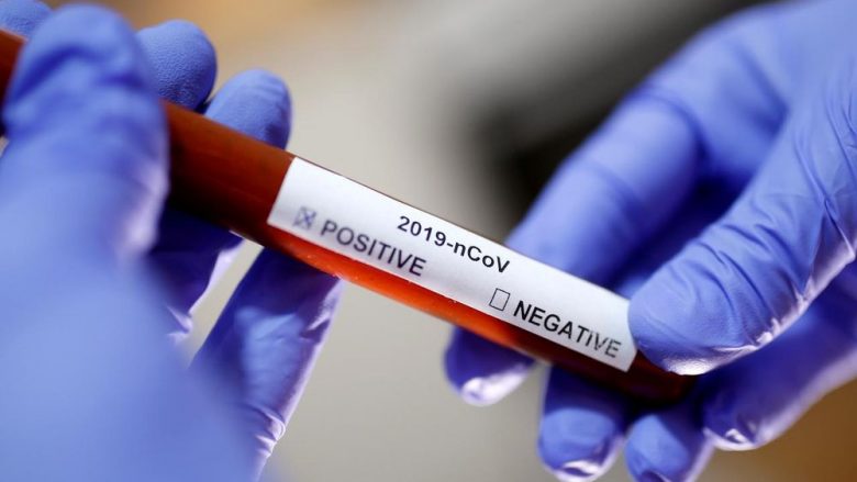 Mijëra suedezë morën rezultat të rremë pozitiv për coronavirus – teste të tilla thuhet se janë shpërndarë edhe në vende të tjera