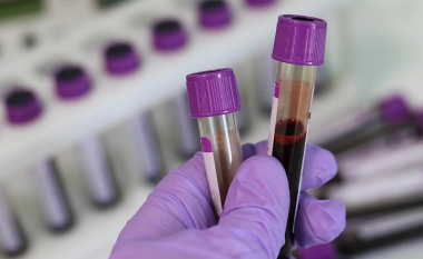MSH licencon pesë laboratore private, dy për teste molekulare dhe tri për serologjike