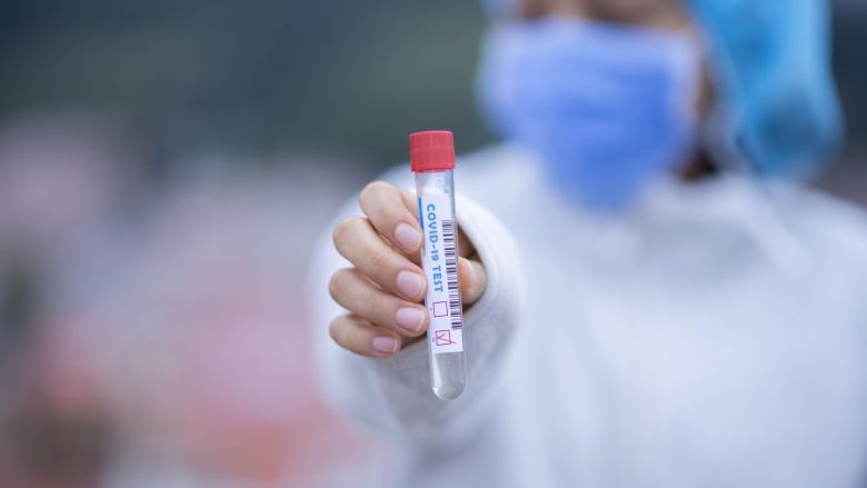 Mali i Zi konfirmon një të vdekur dhe 39 raste të reja me coronavirus