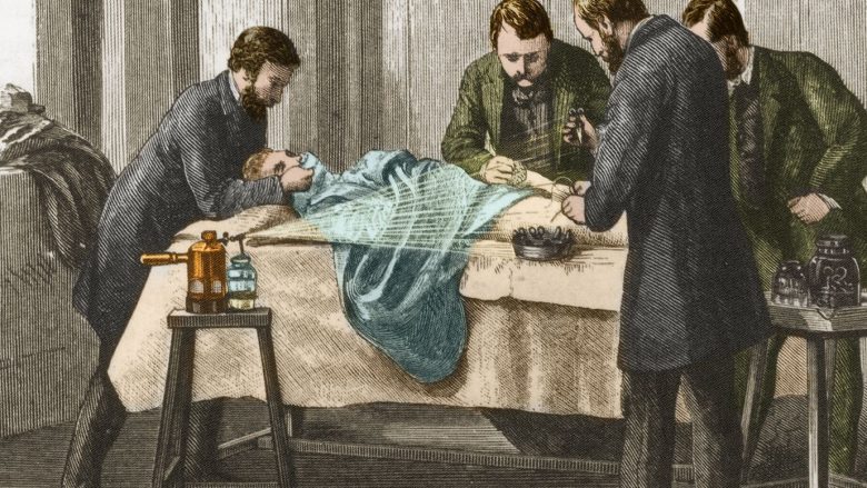 Rrëfimi për kirurgët e parë që filluan sterilizimin e instrumenteve dhe pastrimin e duarve para operacioneve