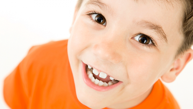 Çfarë duhet të dini për hapësirat ndërmjet dhëmbëve të fëmijëve?