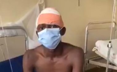 Ia ngulin thikën gjigante në ballë, burri nga Angola i shpëton vdekjes – madje ngritet nga shtrati dhe bisedon pa problem