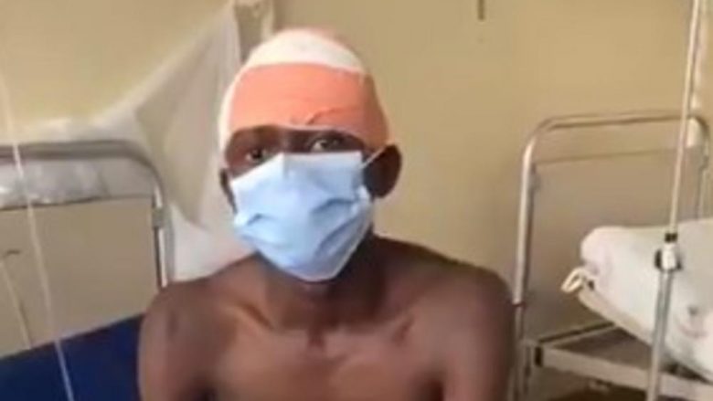 Ia ngulin thikën gjigante në ballë, burri nga Angola i shpëton vdekjes – madje ngritet nga shtrati dhe bisedon pa problem
