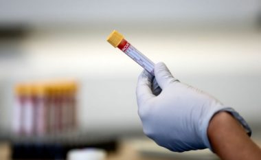 Bosnja raporton 13 të vdekur dhe 242 të infektuar me coronavirus