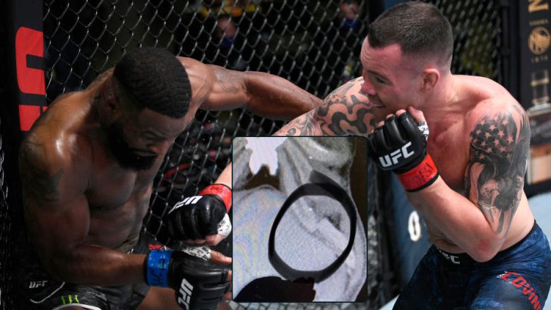 Tyron Woodley theu brinjën në duelin e UFC-së ndaj Colby Covington dhe këtë e dëshmon fotografia rëntgenit