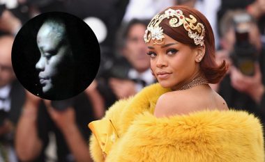 Rihanna aksidentohet me skuter elektrik, fotografohet me të nxira në fytyrë