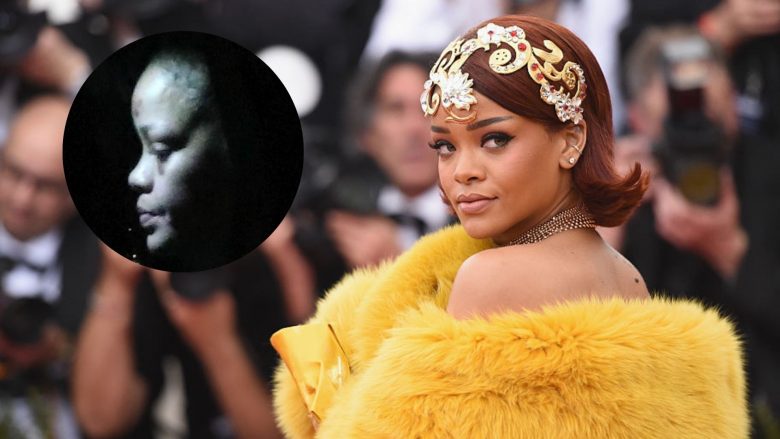 Rihanna aksidentohet me skuter elektrik, fotografohet me të nxira në fytyrë