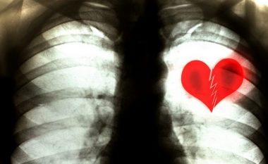 Shpjegon kardiologu: Ju vërtet mund të vdisni nga një zemër e thyer