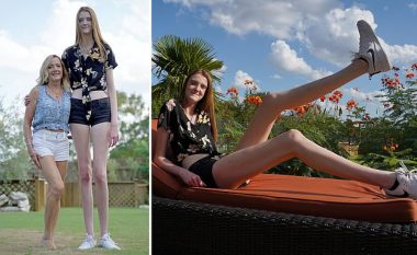 Njihuni me amerikanen 17-vjeçe me këmbët më të gjata në botë