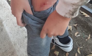 Sulmohet nga qentë endacak një fëmijë në Prishtinë