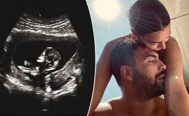 “Po vdes sytë me t’i pa”, Ledri Vula publikon ultrazërin e foshnjës që pret të vijë në jetë