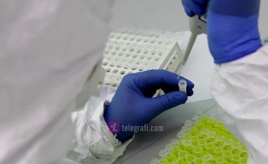 Dhjetë raste të reja me coronavirus brenda 24 orëve