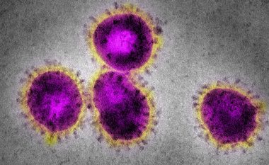 Çfarë i bën viruset të ndizen – tregon mikrobiologu Raka