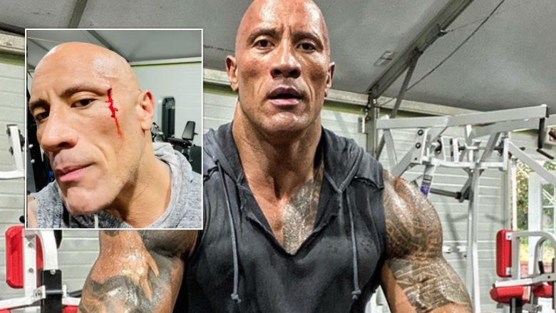 Dwayne ‘The Rock’ Johnson lëndohet gjatë stërvitjeve në palestër, shfaqet i përgjakur në videon e ndarë në Instagram