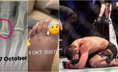 Khabib Nurmagomedov publikon foto nga lëndimet që kishte para meçit me Justin Gaethje ku fitoi dhe pastaj u pensionua nga UFC