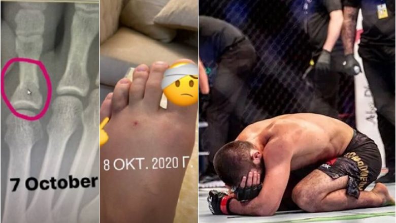 Khabib Nurmagomedov publikon foto nga lëndimet që kishte para meçit me Justin Gaethje ku fitoi dhe pastaj u pensionua nga UFC