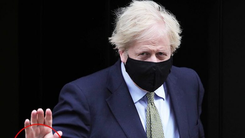 Kryeministri britanik vendos manshetat e këmishës së tij në mënyrën e gabuar