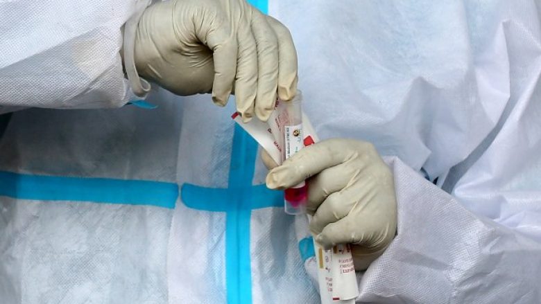 Testimi masiv zbuloi 3,180 raste asimptomatike me coronavirus në Itali