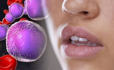 Kanceri i gojës: Kontrolli dyminutësh për simptoma që mund të shpëtojë jetë