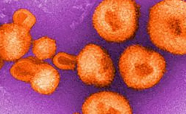Detaje rreth virusit të ngjashëm me Ebola-n, të shfaqur edhe vitin e kaluar në Bolivi: Transmetohet nga personi në person, vret tre deri në pesë pacientë të infektuar