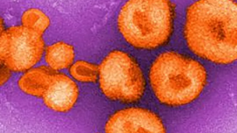 Detaje rreth virusit të ngjashëm me Ebola-n, të shfaqur edhe vitin e kaluar në Bolivi: Transmetohet nga personi në person, vret tre deri në pesë pacientë të infektuar