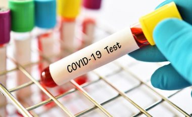Nga dita e marte në Prishtinë kryhen testet e shpejta për coronavirus – rezultatet brenda 20 minutave