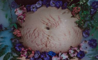 Gratë ndajnë fotografi të trupave të tyre pas lindjes, të gjitha duhet të jenë krenare