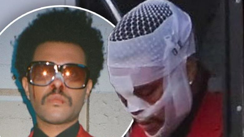 The Weeknd shfaqet i ënjtur dhe me kokën e fashuar në xhirimet e klipit të ri