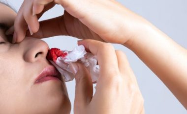 Shkaqet më të shpeshta të gjakderdhjes nga hunda