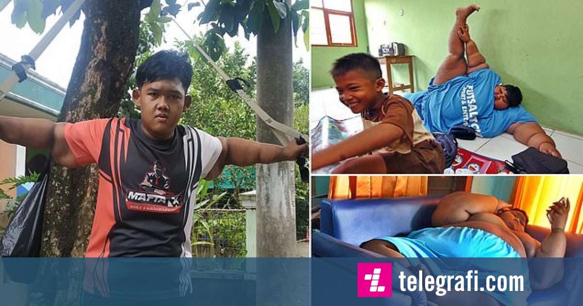 Мальчик 11 лет похудел. Самый толстый мальчик в мире Арья перман. Арья Пермана самый толстый. Арья перман из Индонезии.